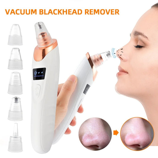 5-in-1 Electric Blackhead Remover Vacuum | Deep Pore Cleaner