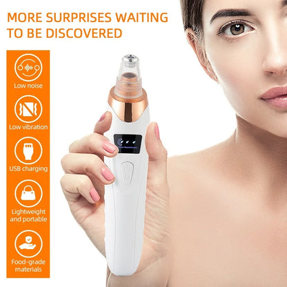 5-in-1 Electric Blackhead Remover Vacuum | Deep Pore Cleaner