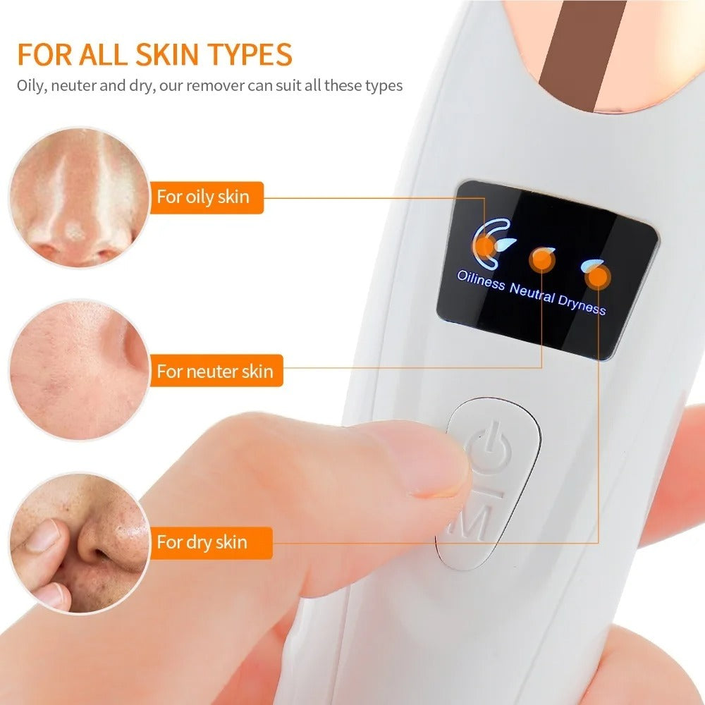 5-in-1 Electric Blackhead Remover Vacuum | Deep Pore Cleaner